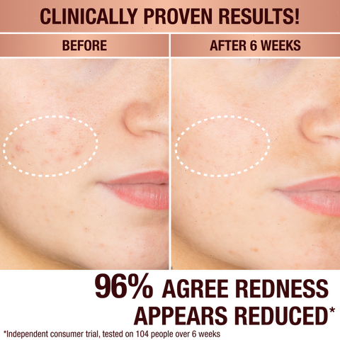 DARK SPOT CORRECTING PROTECT, HYDRATE & GLOW KIT