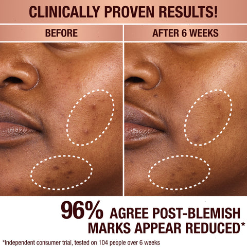 DARK SPOT SERUM & MINI CHARLOTTE’S MAGIC CREAM DUO